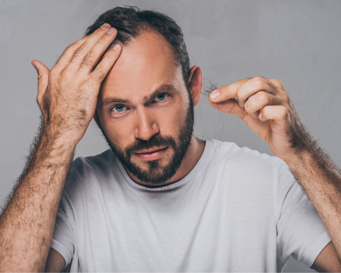 bearded-middle-aged-man-holding-fallen-hair-and-lo-2024-11-17-09-22-03-utc (1)